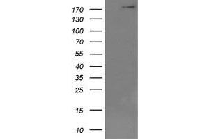 Image no. 1 for anti-Dedicator of Cytokinesis 8 (DOCK8) (AA 833-1160) antibody (ABIN1491684) (DOCK8 抗体  (AA 833-1160))