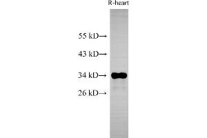Western Blot analysis of Rat heart using Cytochrome c1 Polyclonal Antibody at dilution of 1:500 (Cytochrome C1 抗体)