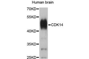 Western blot analysis of extracts of human brain, using CDK14 antibody (ABIN1874104).