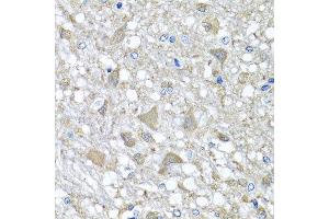 Immunohistochemistry of paraffin-embedded rat brain using VPS37A antibody at dilution of 1:100 (x40 lens). (VPS37A 抗体)