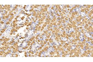 Immunohistochemistry (IHC) image for anti-Sema Domain, Seven Thrombospondin Repeats (Type 1 and Type 1-Like), Transmembrane Domain (TM) and Short Cytoplasmic Domain, (Semaphorin) 5B (SEMA5B) (AA 350-602) antibody (ABIN7426943)