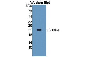 Detection of Recombinant RBM3, Human using Polyclonal Antibody to RNA Binding Motif Protein 3 (RBM3) (RBM3 抗体  (AA 1-157))