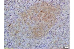 Formalin-fixed and paraffin embedded mouse lymphoma labeled with Anti-IL-17RA/CD217 Polyclonal Antibody, Unconjugated (ABIN747908) at 1:200 followed by conjugation to the secondary antibody and DAB staining