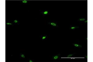 Immunofluorescence of monoclonal antibody to LHX2 on HeLa cell. (LHX2 抗体  (AA 1-76))