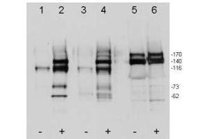 Western blot using ’s affinity purified anti-c-Met pY1349pY1356 antibody shows detection of phosphorylated c-Met. (c-MET 抗体  (pTyr1249, pTyr1356))