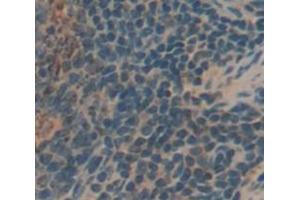 IHC-P analysis of Human Tissue, with DAB staining. (KIR2DS4 抗体  (AA 22-302))
