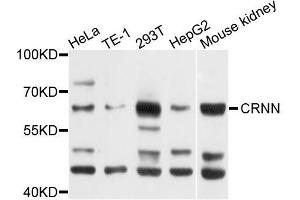 Western blot analysis of extracts of various cell lines, using CRNN antibody (ABIN5996070) at 1/1000 dilution. (CRNN 抗体)
