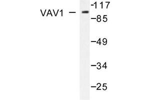 Image no. 2 for anti-Vav 1 Oncogene (VAV1) antibody (ABIN271858) (VAV1 抗体)