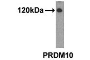 Western analysis of extracts from 293 cells using PRDM10 antibody. (PRDM10 抗体  (N-Term))