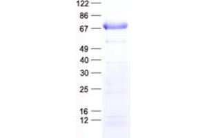 Western Blotting (WB) image for Suppressor of Cytokine Signaling 6 (SOCS6) protein (His tag) (ABIN2732346)