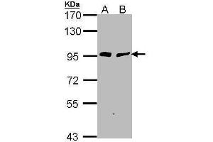 WB Image Sample (30 ug of whole cell lysate) A: H1299 B: Hela 7. (Gelsolin 抗体  (C-Term))