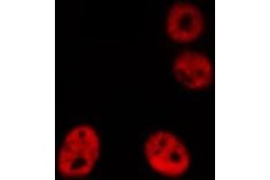 ABIN6276866 staining HeLa cells by IF/ICC. (AIRE 抗体  (Internal Region))