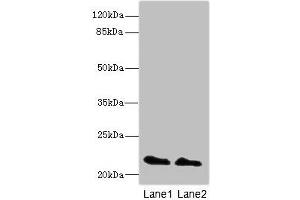 Western blot All lanes: KRAS antibody at 2 μg/mL Lane 1: Mouse brain tissue Lane 2: Mouse kidney tissue Secondary Goat polyclonal to rabbit IgG at 1/10000 dilution Predicted band size: 22 kDa Observed band size: 22 kDa (K-RAS 抗体  (AA 2-168))