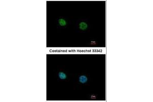 ICC/IF Image Immunofluorescence analysis of paraformaldehyde-fixed HeLa, using NR2C2, antibody at 1:500 dilution. (TR4 抗体)