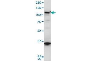 HIP1R monoclonal antibody (M01), clone 3E10 Western Blot analysis of HIP1R expression in A-431 . (HIP1R 抗体  (AA 969-1066))