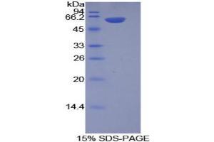 SDS-PAGE analysis of Mouse Integrin alpha 9 Protein. (ITGA9 蛋白)