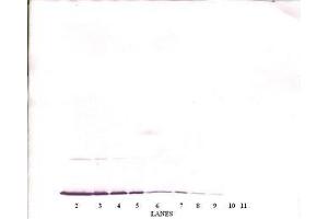 Image no. 2 for anti-Interferon gamma (IFNG) antibody (ABIN464926) (Interferon gamma 抗体)