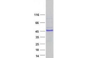 Validation with Western Blot