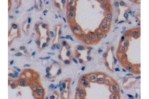 Detection of ErbB2 in Human Kidney Tissue using Polyclonal Antibody to Receptor Tyrosine Protein Kinase erbB-2 (ErbB2) (ErbB2/Her2 抗体  (AA 376-578))