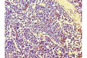 Immunohistochemistry of paraffin-embedded human thymus tissue using ABIN7158664 at dilution of 1:100 (PBK 抗体  (AA 1-322))
