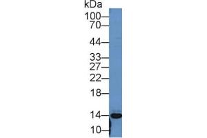 Rabbit Capture antibody from the kit in WB with Positive Control: Mouse spleen lysate. (PF4 CLIA Kit)