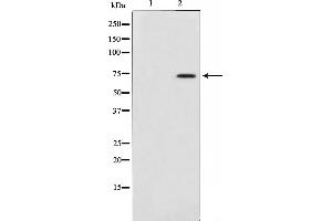 Western blot analysis on HepG2 cell lysate using MAP3K3 Antibody,The lane on the left is treated with the antigen-specific peptide. (MAP3K3 抗体)