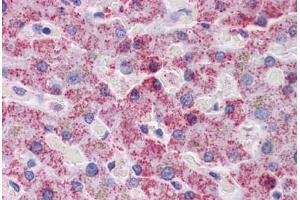 Immunohistochemistry (Formalin-fixed Paraffin-embedded Sections) (IHC (fp)) image for anti-SplA/ryanodine Receptor Domain and SOCS Box Containing 2 (SPSB2) (AA 1-91) antibody (ABIN574466)