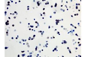 ICC staining of formalin fixed and paraffin embedded human SW40 cells (400X, Negative) with recombinant BRAF V600E antibody. (Recombinant BRAF 抗体  (V600E))
