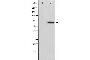 Western blot analysis of Ezrin phosphorylation expression in Na3VO4 treated K562 whole cell lysates,The lane on the left is treated with the antigen-specific peptide.