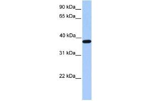 ACTRT2 antibody used at 1 ug/ml to detect target protein. (ACTRT2 抗体  (C-Term))