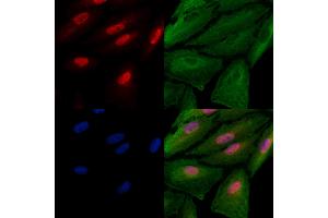 ABIN6262222 and ABIN6278578 staining  cells by IF/ICC. (HES6 抗体  (N-Term))