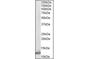 Image no. 1 for anti-Macrophage Migration Inhibitory Factor (Glycosylation-Inhibiting Factor) (MIF) (C-Term) antibody (ABIN372861) (MIF 抗体  (C-Term))