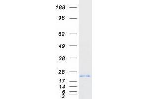 Western Blotting (WB) image for Mitochondrial Ribosomal Protein L13 (MRPL13) protein (Myc-DYKDDDDK Tag) (ABIN2726334)