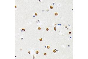 Immunohistochemistry (IHC) image for anti-Polypyrimidine Tract Binding Protein 2 (PTBP2) antibody (ABIN7269465)