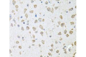 Immunohistochemistry of paraffin-embedded Mouse brain using TARS Polyclonal Antibody at dilution of 1:100 (40x lens). (TARS 抗体)