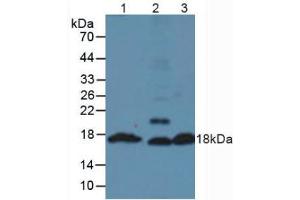 Western blot analysis of (1) Mouse Pancreas Tissue, (2) Mouse Testis Tissue and (3) Mouse Liver Tissue. (Insulin 抗体  (AA 25-54, AA 90-110))