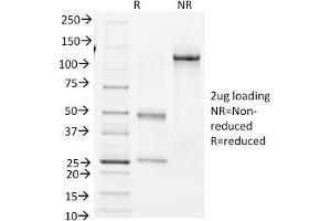 SDS-PAGE Analysis Purified BCL-6 Mouse Monoclonal Antibody (BCL6/1982). (BCL6 抗体  (AA 256-389))