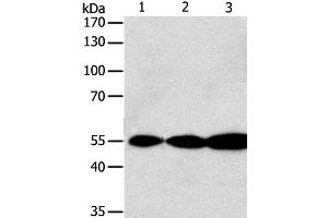 Western Blot analysis of Jurkat, Hela and A549 cell using GSR Polyclonal Antibody at dilution of 1:750 (Glutathione Reductase 抗体)