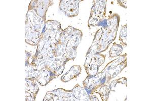 Immunohistochemistry (IHC) image for anti-Melanoma Antigen Family D, 1 (MAGED1) (AA 635-834) antibody (ABIN3021415)