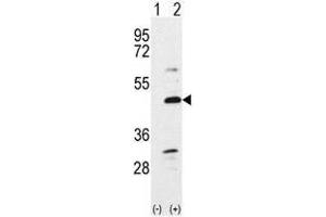 Image no. 1 for anti-Bone Morphogenetic Protein 7 (BMP7) (N-Term) antibody (ABIN357185) (BMP7 抗体  (N-Term))