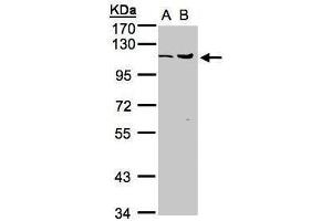 Western Blotting (WB) image for anti-Ubiquitin Specific Peptidase 5 (USP5) antibody (ABIN2856099)