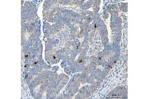 IHC analysis of Chromogranin A/CHGA using anti-Chromogranin A/CHGA antibody (ABIN7600415).