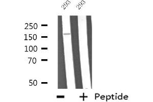 Western blot analysis of extracts from 293 cells, using ABCA6 antibody. (ABCA6 抗体  (Internal Region))