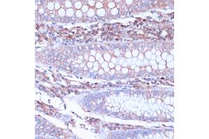 Immunohistochemistry of paraffin-embedded human colon using CD38 antibody (ABIN6130076, ABIN6138177, ABIN6138178 and ABIN6217677) at dilution of 1:100 (40x lens). (CD38 抗体  (AA 46-300))