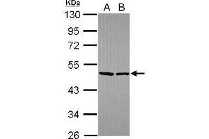 WB Image Sample (30 ug of whole cell lysate) A: Hela B: Hep G2 , 10% SDS PAGE antibody diluted at 1:10000 (EIF4A2 抗体)