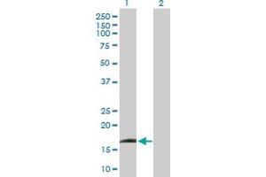 Western Blot analysis of IFNA13 expression in transfected 293T cell line by IFNA13 MaxPab polyclonal antibody. (IFNA13 抗体  (AA 1-189))
