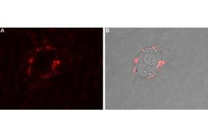 Immunocytochemistry (ICC) image for anti-Adenosine A2b Receptor (ADORA2B) (AA 147-166), (C154S), (Extracellular) antibody (ABIN7042889)