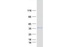 Validation with Western Blot