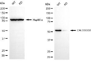 anti-Calcium Binding and Coiled-Coil Domain 2 (CALCOCO2) antibody
