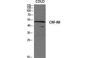 Western Blot (WB) analysis of specific cells using CRF-RII Polyclonal Antibody. (CRHR2 抗体  (Internal Region))